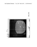 TISSUE RESECTION AND TREATMENT WITH SHEDDING PULSES diagram and image