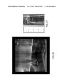 TISSUE RESECTION AND TREATMENT WITH SHEDDING PULSES diagram and image