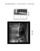 TISSUE RESECTION AND TREATMENT WITH SHEDDING PULSES diagram and image