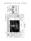 TISSUE RESECTION AND TREATMENT WITH SHEDDING PULSES diagram and image