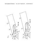 TISSUE RESECTION AND TREATMENT WITH SHEDDING PULSES diagram and image