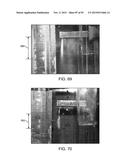 TISSUE RESECTION AND TREATMENT WITH SHEDDING PULSES diagram and image