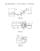 TISSUE RESECTION AND TREATMENT WITH SHEDDING PULSES diagram and image