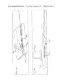 DEVICES AND METHODS FOR FORMING A FISTULA diagram and image