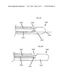 DEVICES AND METHODS FOR FORMING A FISTULA diagram and image