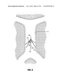 METHOD OF INSERTING A VEIN FILTER diagram and image