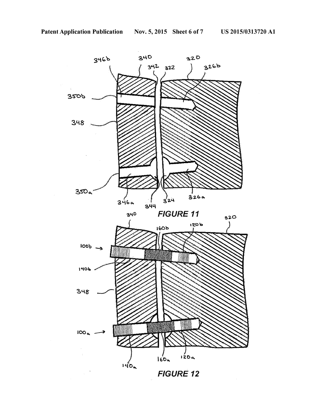 SACROILIAC JOINT FASTENER, SYSTEMS, AND METHODS OF USING THE SAME - diagram, schematic, and image 07