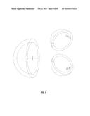 ACETABULAR COMPONENT ANTEVERSION AND ABDUCTION MEASUREMENT SYSTEM AND     METHOD diagram and image