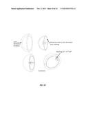 ACETABULAR COMPONENT ANTEVERSION AND ABDUCTION MEASUREMENT SYSTEM AND     METHOD diagram and image