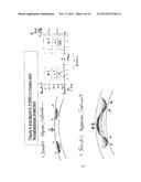 FEMTO SECOND MULTI SHOOTING FOR EYE SURGERY diagram and image