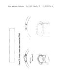 FEMTO SECOND MULTI SHOOTING FOR EYE SURGERY diagram and image