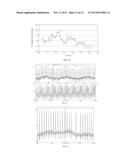 UNIT DOSES, AEROSOLS, KITS, AND METHODS FOR TREATING HEART CONDITIONS BY     PULMONARY ADMINISTRATION diagram and image