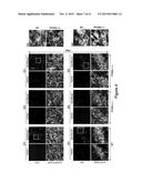 Composition and Method for Treating Neuronal Ceroid Lipofuscinosis diagram and image