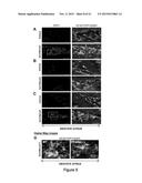 Composition and Method for Treating Neuronal Ceroid Lipofuscinosis diagram and image