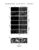 Composition and Method for Treating Neuronal Ceroid Lipofuscinosis diagram and image