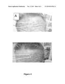 COMPOSITIONS OF ALUMINUM FLUORIDE AND METHODS OF USE THEREOF FOR THE     TREATMENT AND PREVENTION OF ACTINIC KERATOSIS AND SUN-INDUCED DAMAGES diagram and image