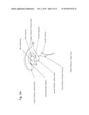 INTRAVENTRICULAR ENZYME DELIVERY FOR LYSOSOMAL STORAGE DISEASES diagram and image