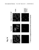 POTENTIATION OF ANTICANCER AGENTS diagram and image