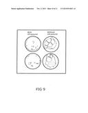 STERILIZATION METHOD COMPRISING STERILIZATION FLUID AND ULTRASONICALLY     GERERATED CAVITATION MICROBUBBLES diagram and image