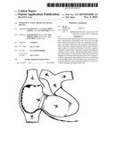 PERMANENT TOTAL ARTIFICIAL HEART DEVICE diagram and image