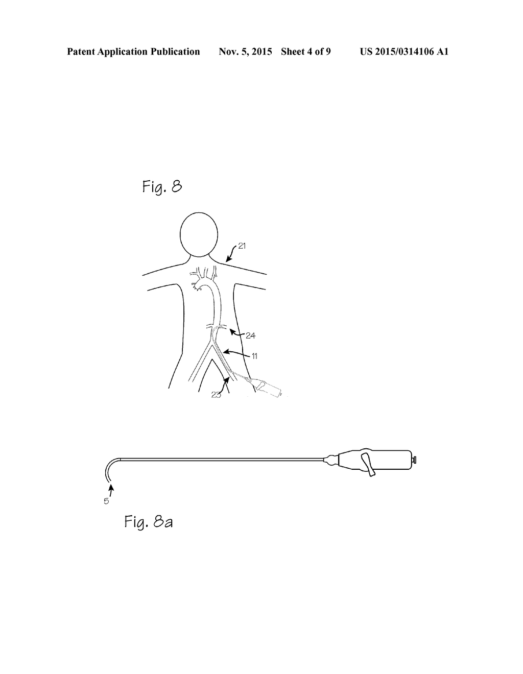 Devices and Methods for Accessing the Vasculature of a Patient - diagram, schematic, and image 05