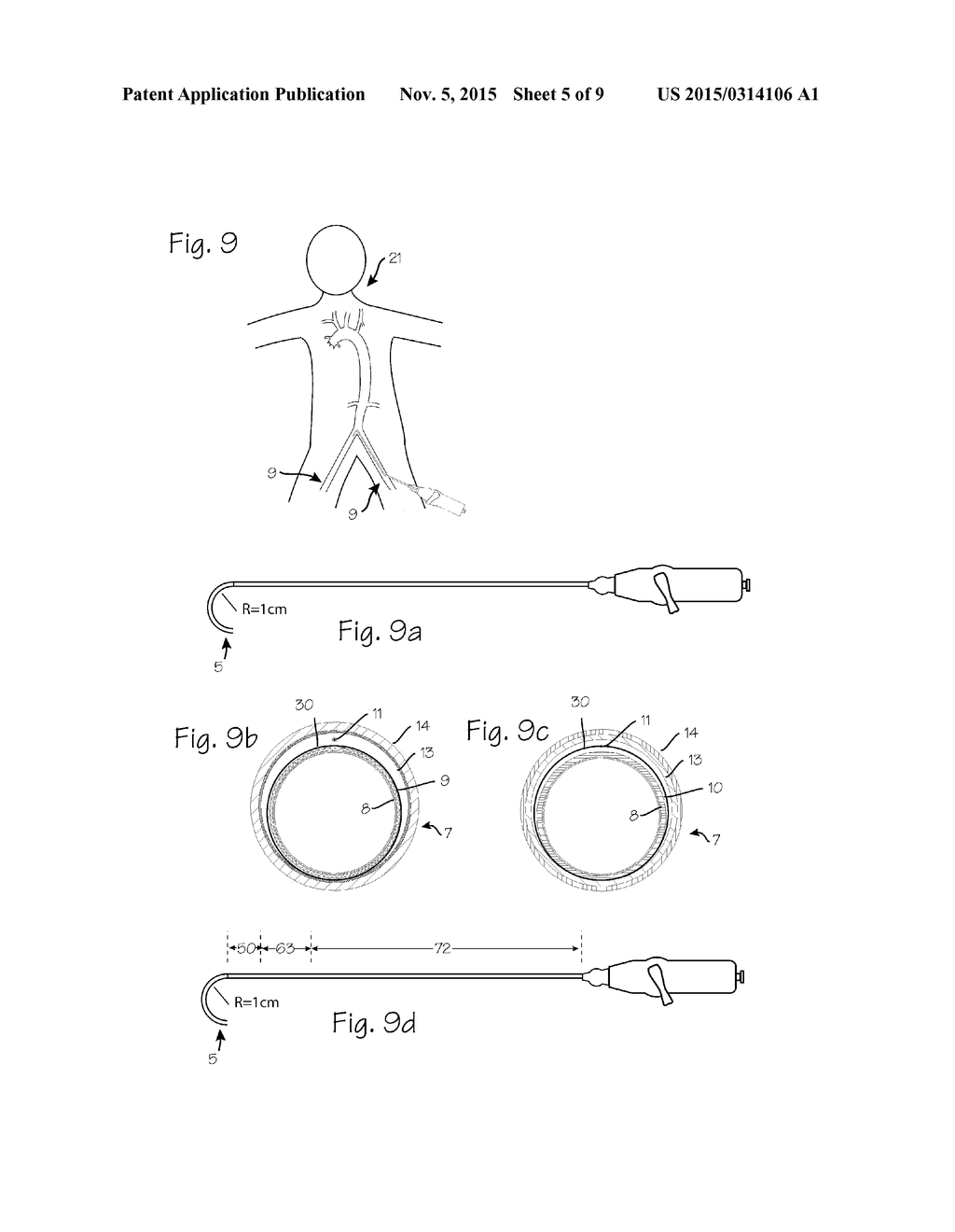 Devices and Methods for Accessing the Vasculature of a Patient - diagram, schematic, and image 06