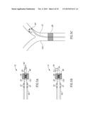 VARIABLE LENGTH CATHETER FOR TREATING A VESSEL CONTAINING THROMBUS diagram and image