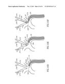 VARIABLE LENGTH CATHETER FOR TREATING A VESSEL CONTAINING THROMBUS diagram and image