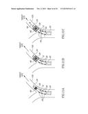 VARIABLE LENGTH CATHETER FOR TREATING A VESSEL CONTAINING THROMBUS diagram and image