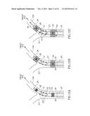 VARIABLE LENGTH CATHETER FOR TREATING A VESSEL CONTAINING THROMBUS diagram and image