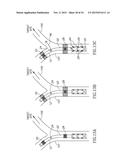 VARIABLE LENGTH CATHETER FOR TREATING A VESSEL CONTAINING THROMBUS diagram and image