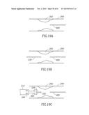 VARIABLE LENGTH CATHETER FOR TREATING A VESSEL CONTAINING THROMBUS diagram and image