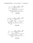 VARIABLE LENGTH CATHETER FOR TREATING A VESSEL CONTAINING THROMBUS diagram and image