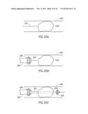 VARIABLE LENGTH CATHETER FOR TREATING A VESSEL CONTAINING THROMBUS diagram and image