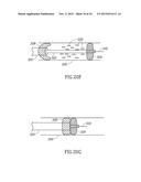 VARIABLE LENGTH CATHETER FOR TREATING A VESSEL CONTAINING THROMBUS diagram and image