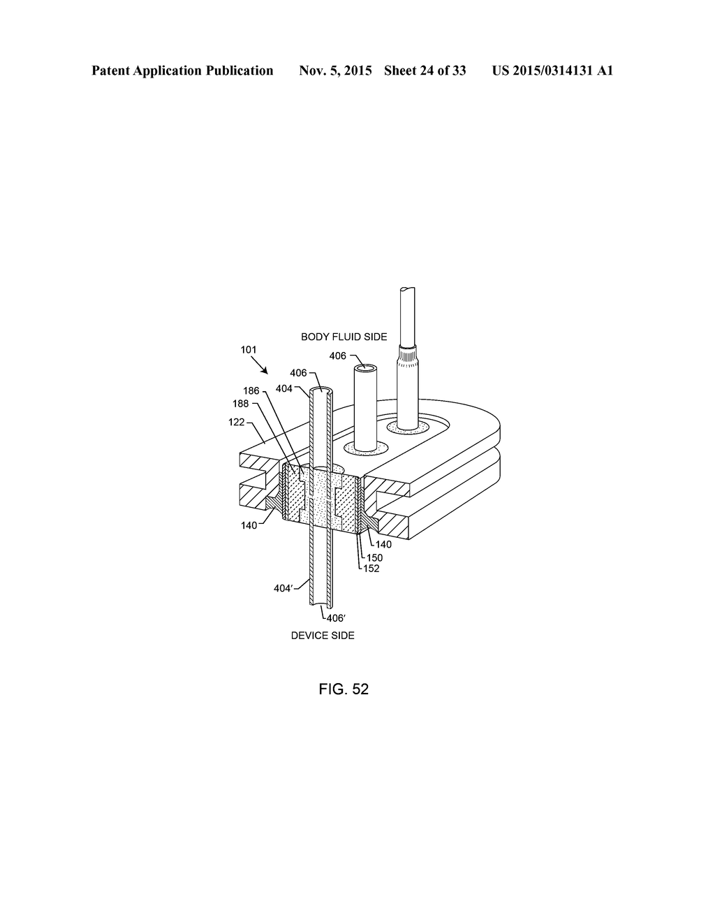 HERMETICALLY SEALED FEEDTHROUGH WITH CO-FIRED FILLED VIA AND CONDUCTIVE     INSERT FOR AN ACTIVE IMPLANTABLE MEDICAL DEVICE - diagram, schematic, and image 25