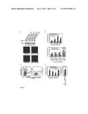 NON-INVASIVE DETECTION OF BLADDER CANCER BY FLOURESCENCE IN SITU     HIBRIDIZATION OF AURORA A diagram and image