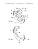 Flow Conditioner with Integral Vanes diagram and image