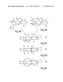 LEAF SPRING MADE OF A FIBER COMPOSITE MATERIAL HAVING INTEGRATED BEARING     EYES AND METHOD OF PRODUCING SAID LEAF SPRING diagram and image