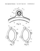 Torsional Vibration Damper diagram and image