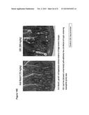 Human Notch Receptor Mutations and Their Use diagram and image