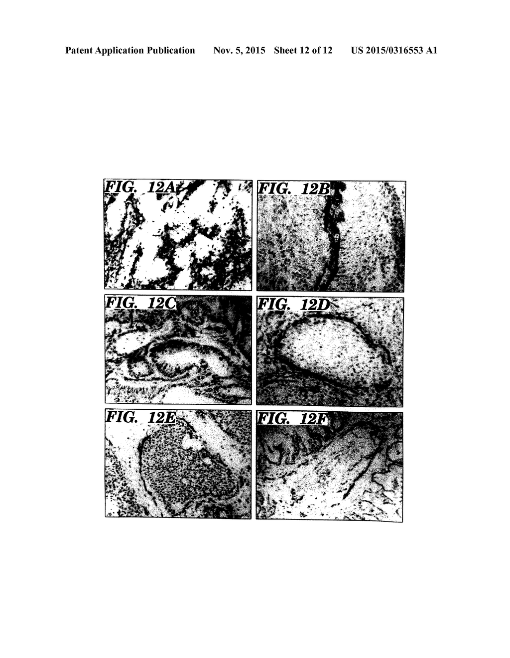 TREATMENT AND DIAGNOSIS OF CANCER - diagram, schematic, and image 13