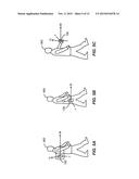 MOTION DIRECTION DETERMINATION AND APPLICATION diagram and image