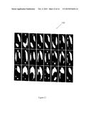 Nuclear Magnetic Resonance (NMR) Fingerprinting With Parallel Transmission diagram and image