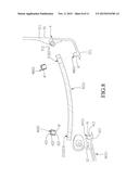 RIMLESS EYEGLASSES diagram and image