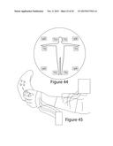 Accelerated Learning, Entertainment and Cognitive Therapy Using Augmented     Reality Comprising Combined Haptic, Auditory, and Visual Stimulation diagram and image