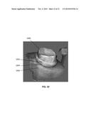 SYSTEMS, METHODS, APPARATUSES, AND COMPUTER-READABLE STORAGE MEDIA FOR     COLLECTING COLOR INFORMATION ABOUT AN OBJECT UNDERGOING A 3D SCAN diagram and image