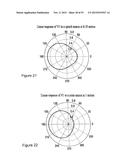 WIND SUPPRESSION/REPLACEMENT COMPONENT FOR USE WITH ELECTRONIC SYSTEMS diagram and image