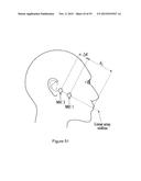 WIND SUPPRESSION/REPLACEMENT COMPONENT FOR USE WITH ELECTRONIC SYSTEMS diagram and image