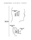 WIND SUPPRESSION/REPLACEMENT COMPONENT FOR USE WITH ELECTRONIC SYSTEMS diagram and image